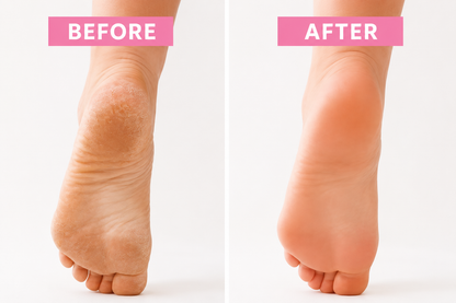 90 Minute Foot Renewal Mask | Exfoliating Foot Peel