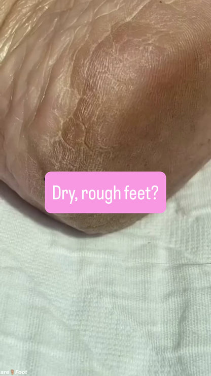 90 Minute Foot Renewal Mask – Exfoliating Foot Peel