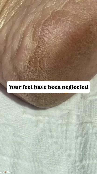 90 Minute Foot Renewal Mask | Exfoliating Foot Peel
