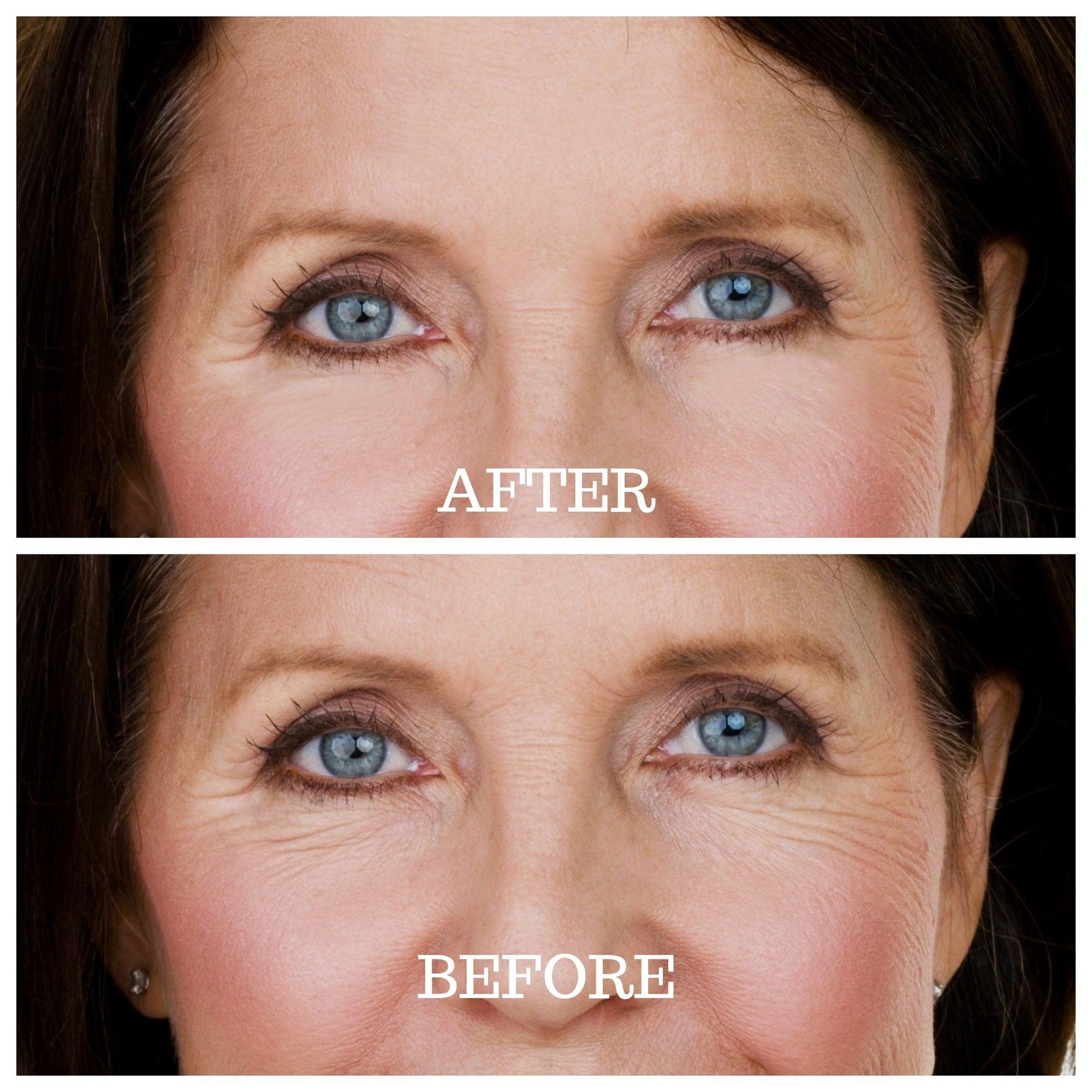 Skin Plumping Eye Wrinkle Reducer [Reusable Silicone Pad] - Dreambox Beauty