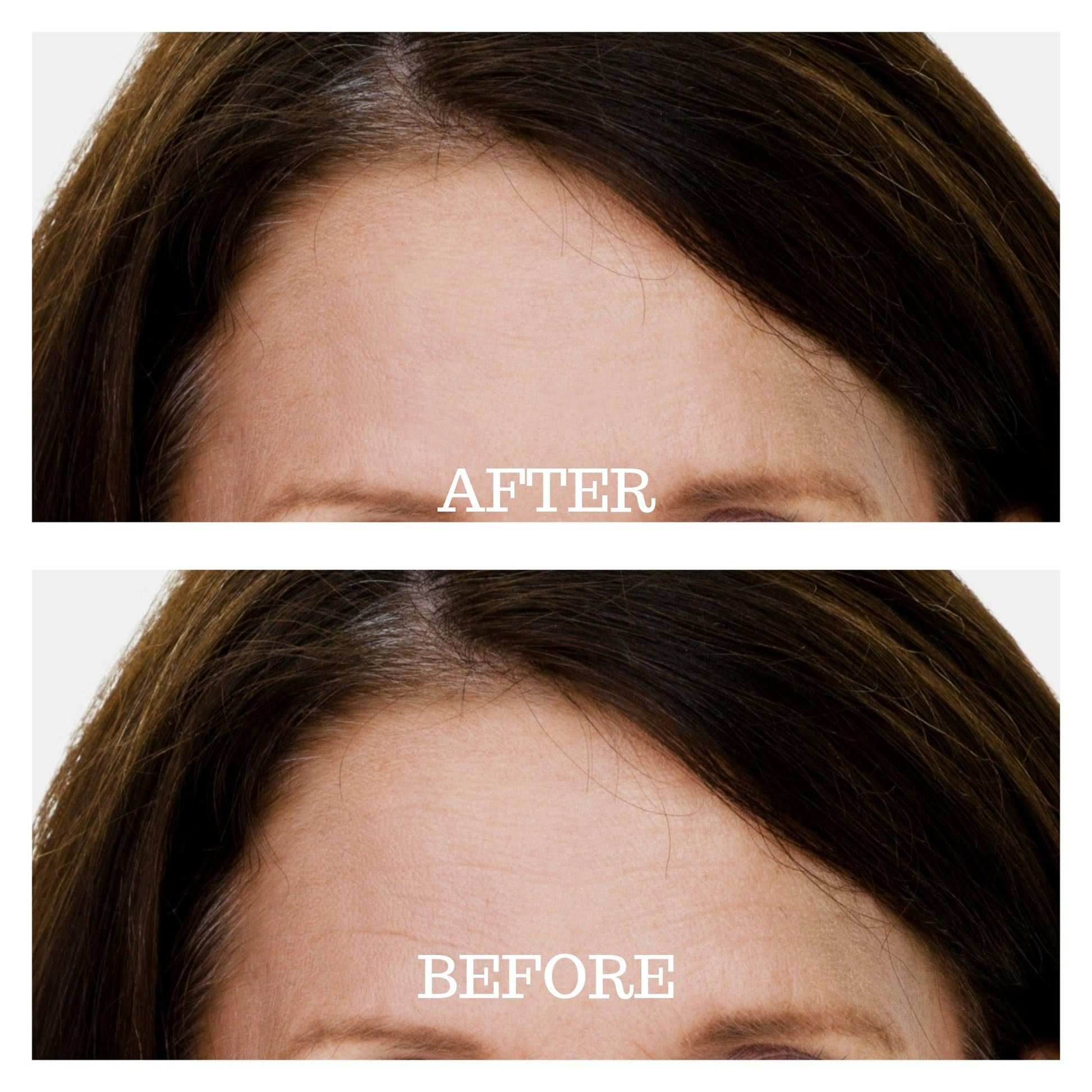 Skin Plumping Forehead Wrinkle Reducer [Reusable Silicone Pad] - Dreambox Beauty