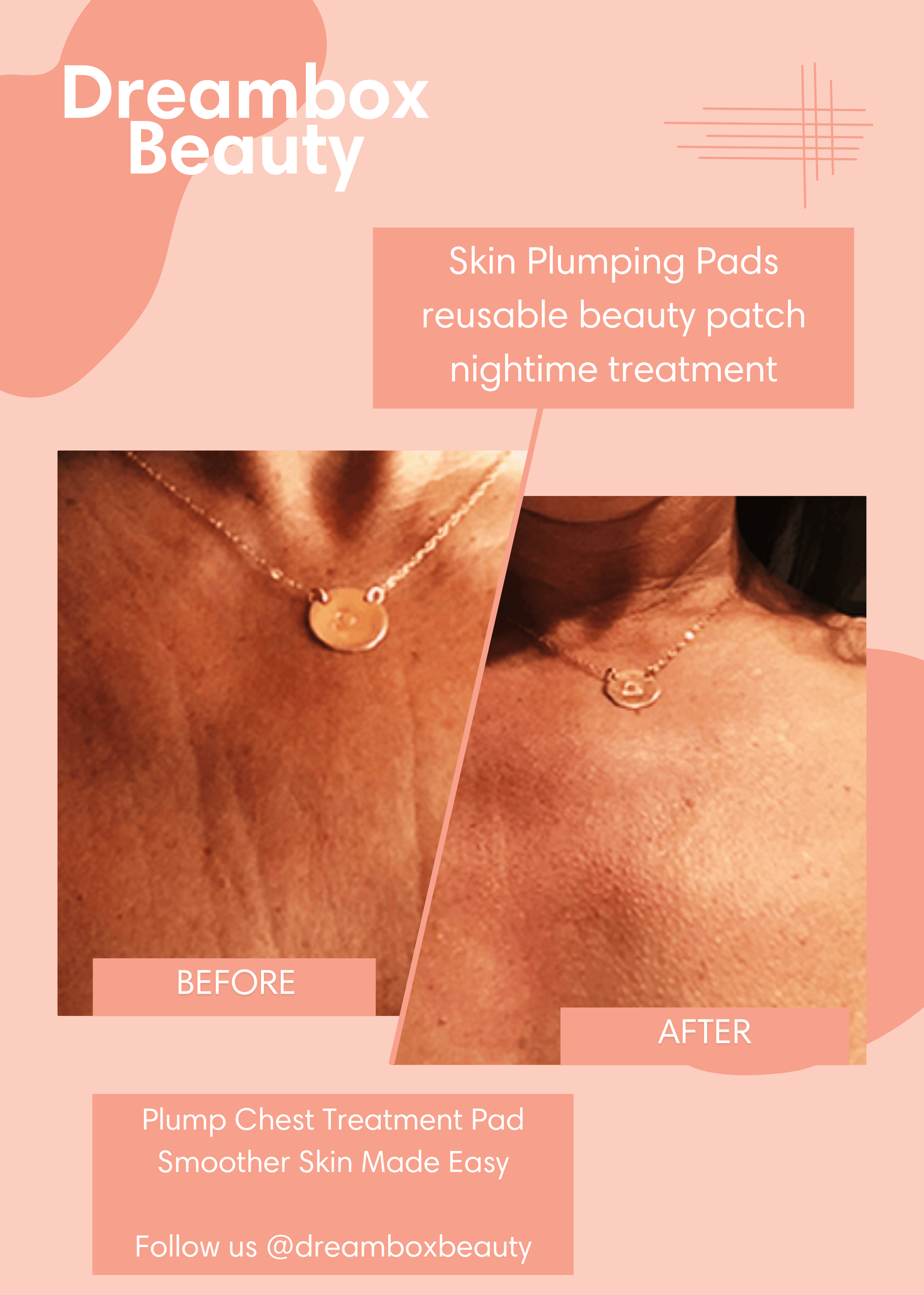 Skin Plumping Chest Wrinkle Reducer [Reusable Silicone Pad] - Dreambox Beauty