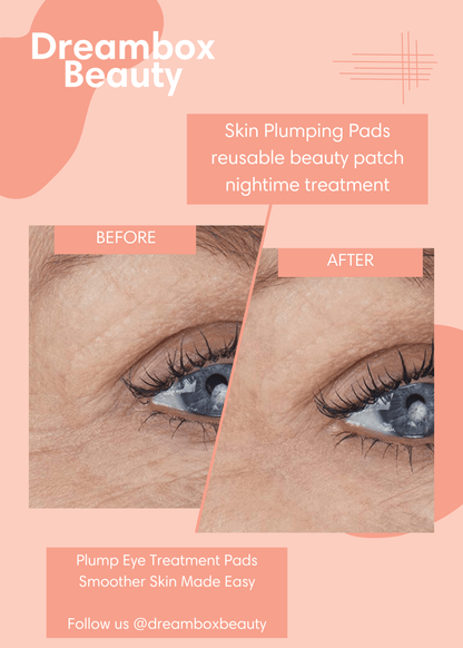 Skin Plumping Eye Wrinkle Reducer [Reusable Silicone Pad] - Dreambox Beauty