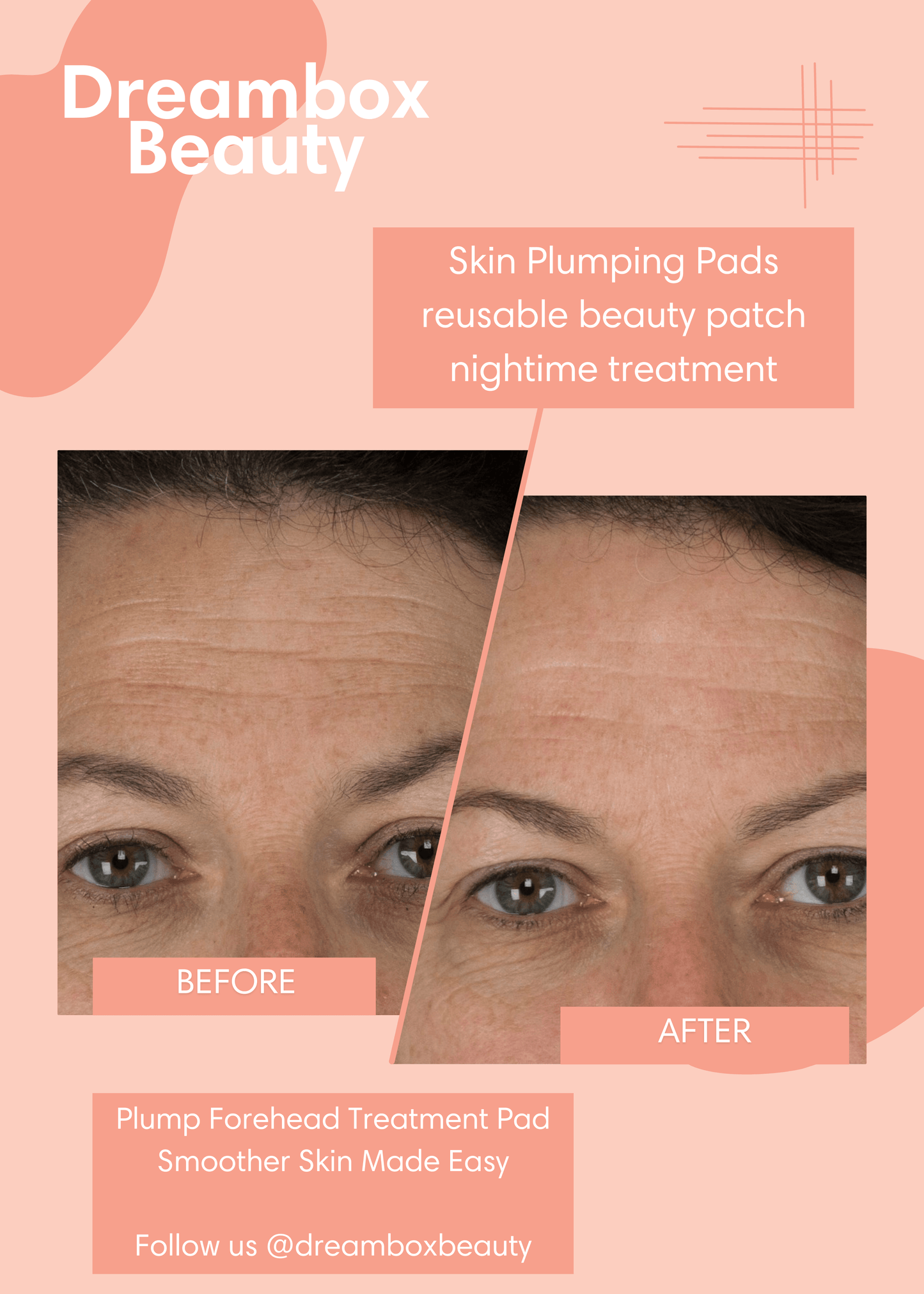 Skin Plumping Forehead Wrinkle Reducer [Reusable Silicone Pad] - Dreambox Beauty